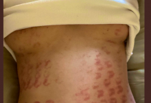 【乐玩LEWIN】除毛搞得一身伤！宝生リリー(宝生莉莉)恐生涯终结！-乐玩真人线上娱乐