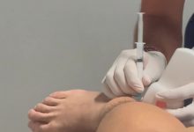 【乐玩LEWIN】看着都觉得疼！何小珂晒伤势治疗视频：全力恢复⌛️-乐玩真人线上娱乐