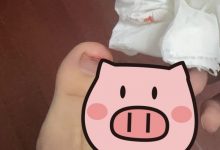 【乐玩LEWIN】iG俱乐部辅助Wink：兄弟们关门要小心，刚才夹伤右脚大拇指了-乐玩真人线上娱乐