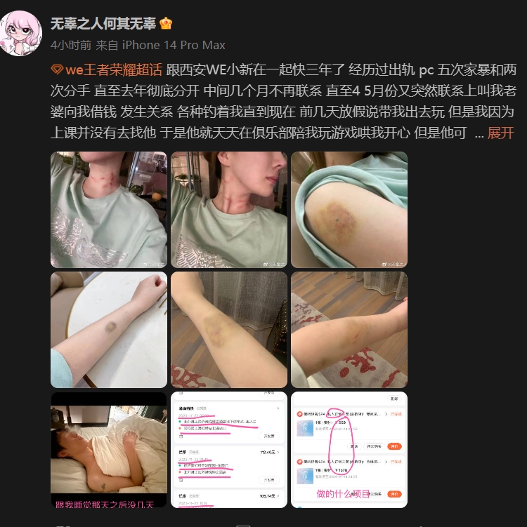 震惊西安第一拳！WE王者教练小新被锤：多次家暴 吃软饭还出轨+天价PC