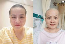 【乐玩LEWIN】岳云鹏老婆回应生病剃光头！ 她得了什么病身体现状如何-乐玩真人线上娱乐