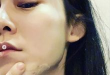 【乐玩LEWIN】范玮琪发生了什么下巴缝15针?为何其那么遭网友嫌弃?-乐玩真人线上娱乐