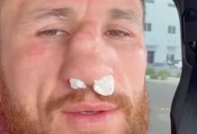 梅拉布·德瓦利什维利鼻骨两处骨折仍要打!放话硬刚亨利·塞胡多,大发体育助力你的致富之路!-乐玩真人线上娱乐